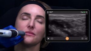 Clarius HD3 3
