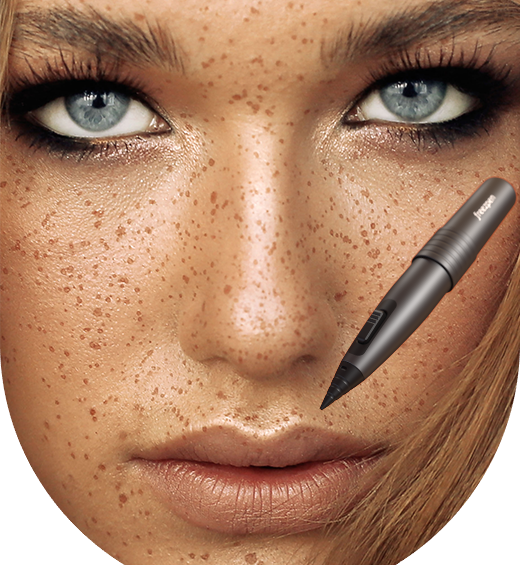 Freezpen 1