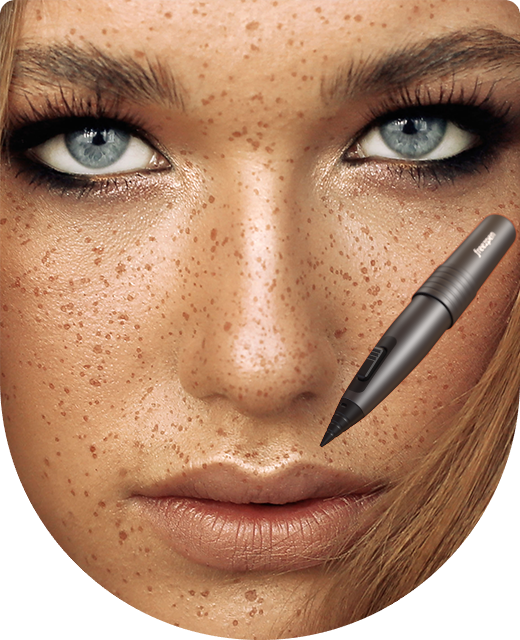 Freezpen 1