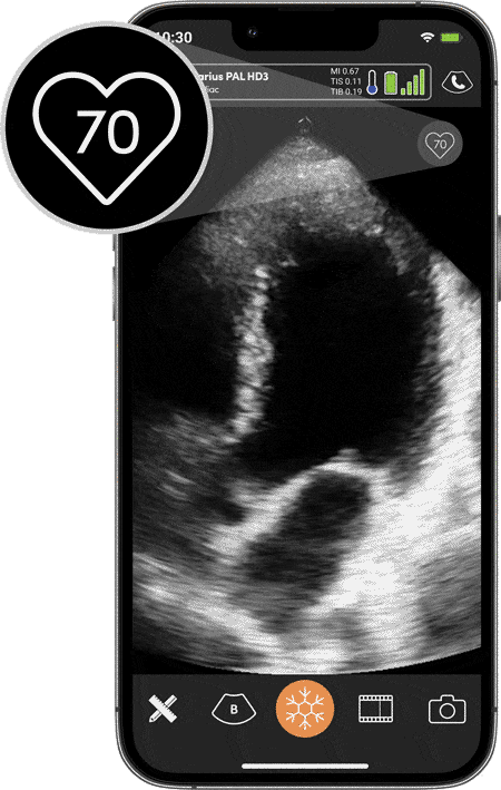 Phone Portrait Video Heart Rate ezgif.com optimize