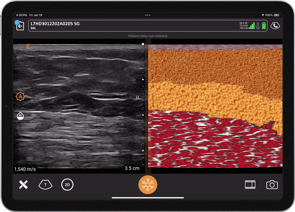 Tablet Layer Stratification