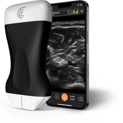 PAL Scanner with Phone Ulnar Nerve 1.png 1000x999 2