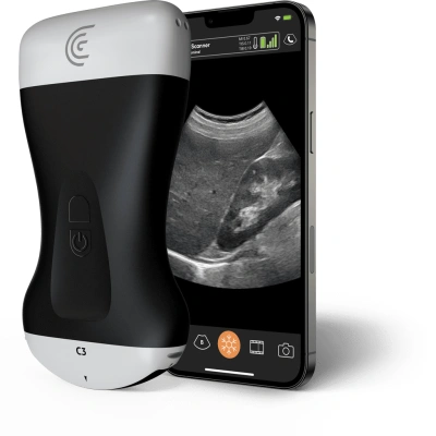 Product C3 Convex Handheld Portable Wireless Ultrasound Scanner.png