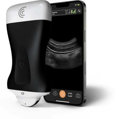Product C7 Microconvex Handheld Portable Wireless Ultrasound Scanner.png
