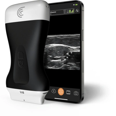 Product L15 High Freq Linear Handheld Portable Wireless Ultrasound Scanner.png