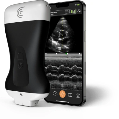 Product PA Phased Array Handheld Portable Wireless Ultrasound Scanner.png